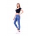 Kadın Açık Mavi Slim Yırtık Desenli Yüksek Bel Kot Pantolon